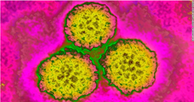 HPVirus